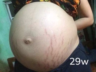 KEM RẠN MULTI 16 Hũ to