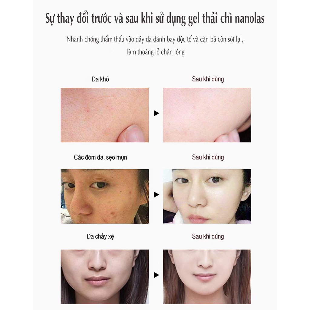 Gel Thải Chì Da Mặt Thải Độc Tố, Dưỡng Trắng Da Mặt, Mờ Thâm 150ml