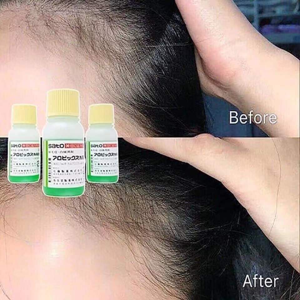 Tinh Chất Kích Thích Mọc Tóc Thảo Dược SATO Nhật Bản - 30ml
