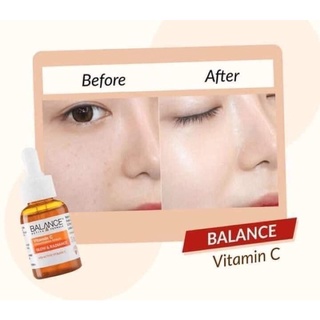 Serum vitamin C balance