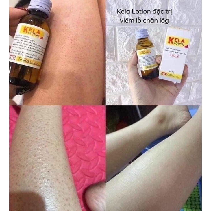 KELA LOTION vıe. m LỖ châŋ LÔNG THÁI LAN 60M