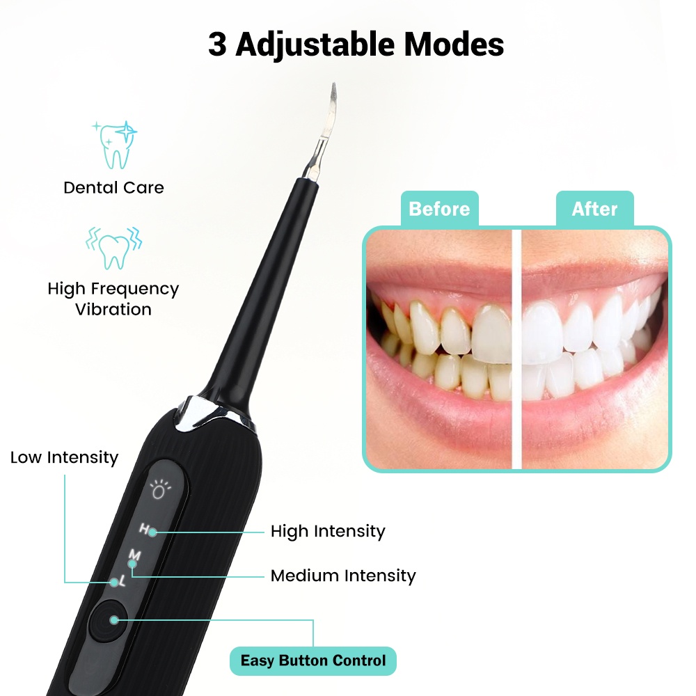Máy cạo vôi răng tần số cao điện siêu âm bằng điện tiện dụng để vệ sinh chăm sóc răng miệng hiệu quả