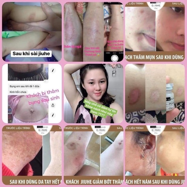 SERUM JIUHE THANH TÔ PHIÊN BẢN MỚI 2021