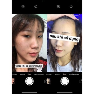 Serum Hunie