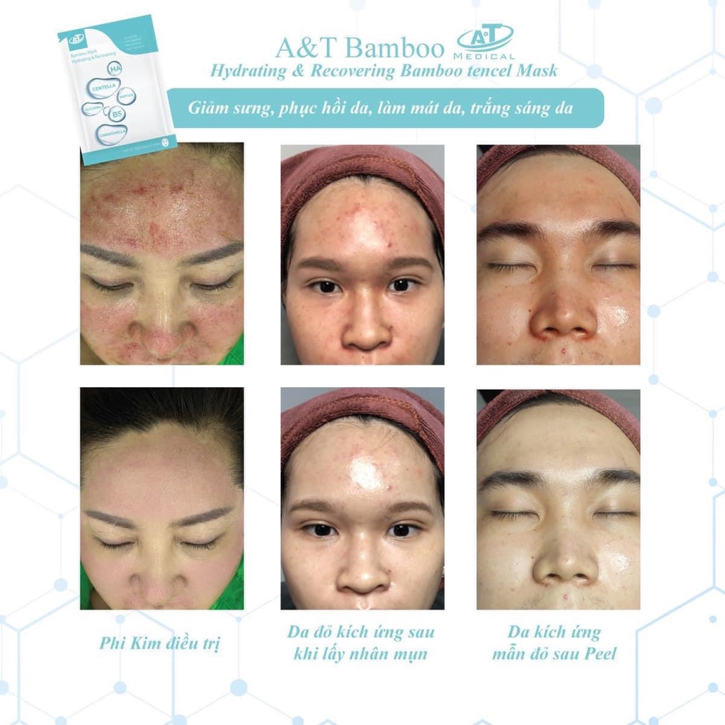 Mặt Nạ Phục Hồi Cấp Ẩm Da Tinh Chất B5 AT Bamboo Mask