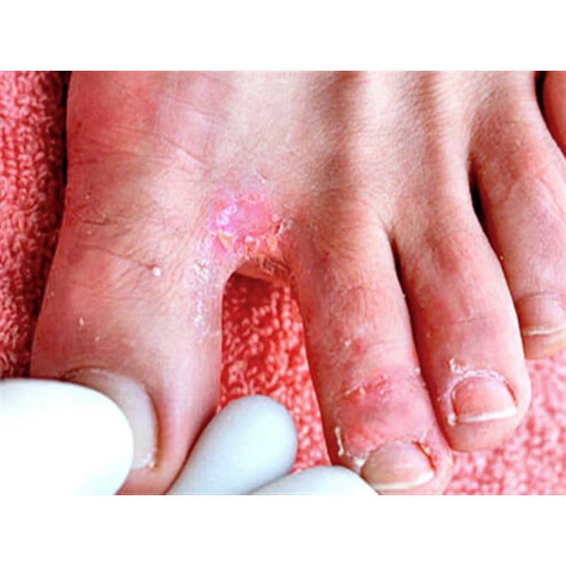 Kem Nứt Gót Chân Sali - B Cream 30g