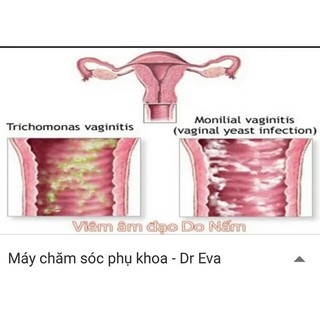 Thiết bị vệ sinh Phụ Khoa DR-EVA