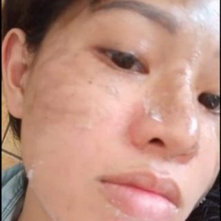 Kem Trắng Da Xóa Nám Sạm Cao Cấp