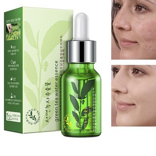 Serum giảm Mụn, Dưỡng Da Trà Xanh Rorec 15ml