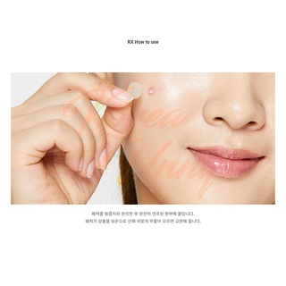 Miếng Dán Hỗ trợ giảm mụn cosrx (24 Miếng)