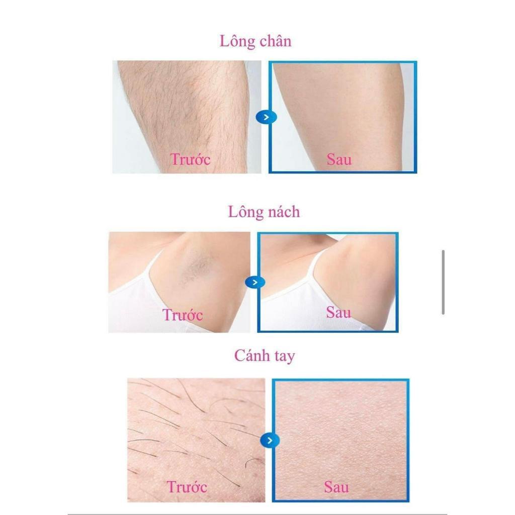 ShakShashak Removal Cream Kem Tẩy Lông Monster Factory 100 g, Triệt Lông Nhanh Chóng, Dịu Da - Săn Sale Hương Chất