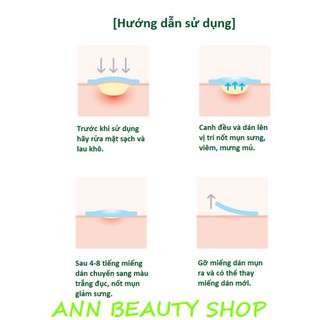 Miếng Dán Mụn Some By Mi Clear Spot Patch