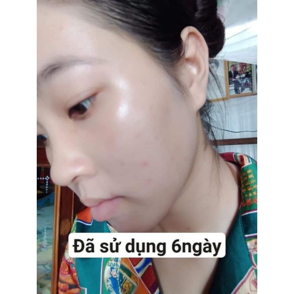 COMBO FECA SERUM SỮA RỮA MẶT COLLAGEN GK CHÍNH HÃNG