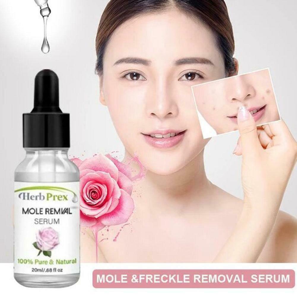 (Hàng Mới Về) Tinh Dầu Hữu Cơ 20ml Loại Bỏ Nốt Ruồi Hiệu Quả P6Q0 | BigBuy360 - bigbuy360.vn