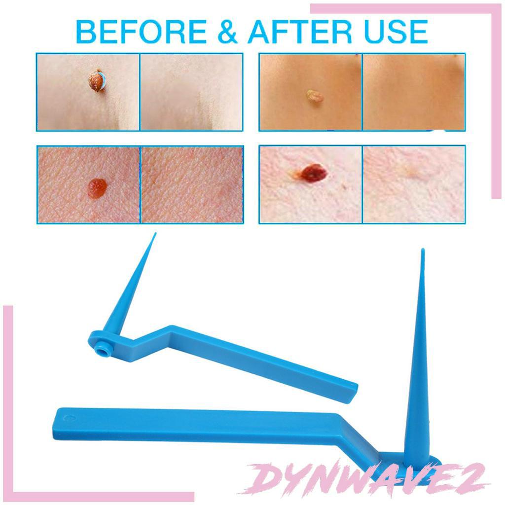 Bộ Dụng Cụ Loại Bỏ Đốm Đen Trên Da Dynwave2