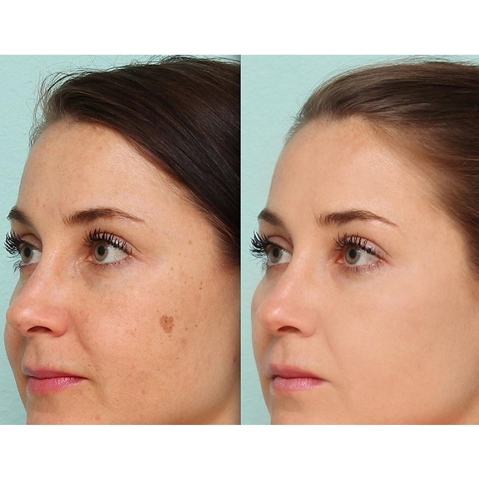 Serum huyết thanh dưỡng trắng da, mờ thâm, chống lão hoá ECOS Arbutin 5% Whiening