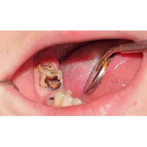 Dầu trị đau răng nhức răng Thái lan M.16 trong vong 1 not nhac