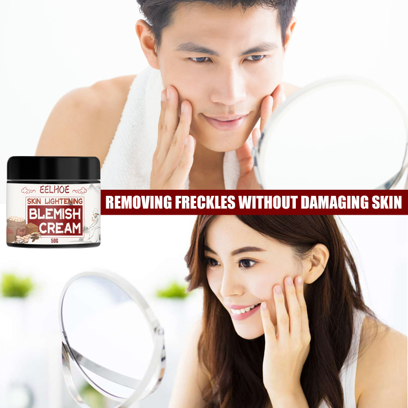 Powerful freckles cream whitening cream  to remove freckles and dark spots  facial skin care whitening cream WIND