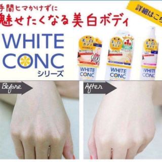 Sữa tắm trắng white conc