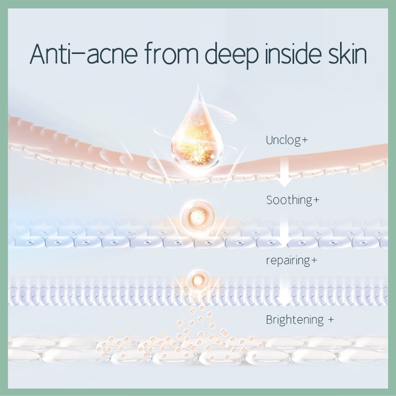 Mặt nạ Hanajirushi giảm mụn làm sáng da hình quả trứng 10g*5