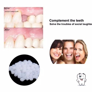 Keo Dán Răng Giả/Sơn Trơn 150 Tốc Độ