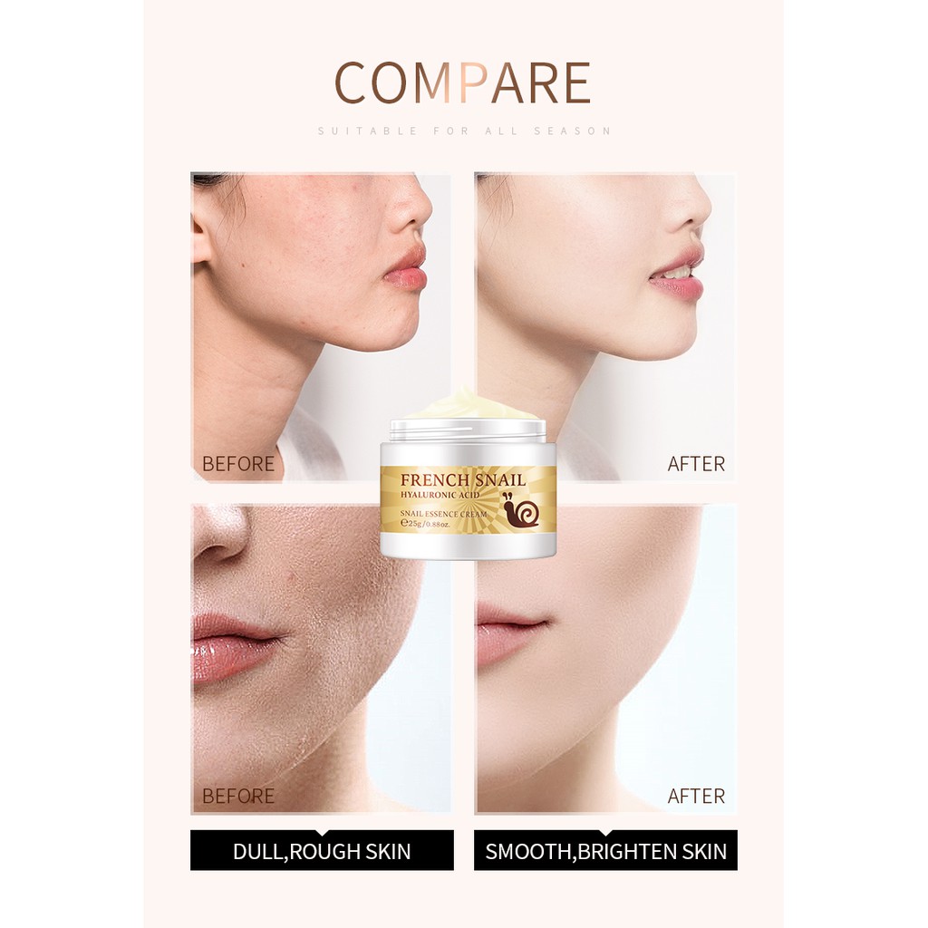 Serum vàng 24k + kem dưỡng da mặt LAIKOU Set chiết xuất từ ​​ốc sên chống lão hóa dưỡng ẩm làm trắng da