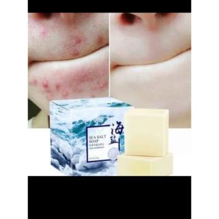 Xà phòng rữa mặt muối biển SEA SALT SOAP,,,