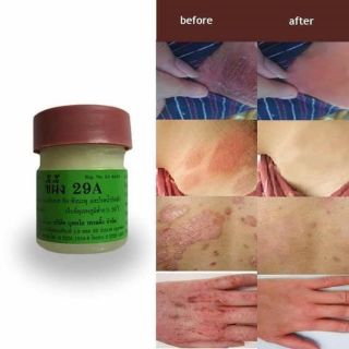 Kem 29A ( hắc lào, lang beng, nấm móng) thái000