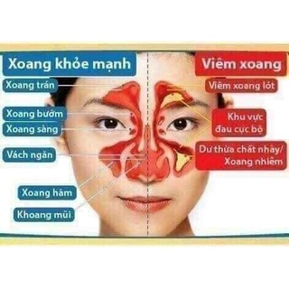 Dung Dịch Xoang Mũi Dạ Thảo Liên