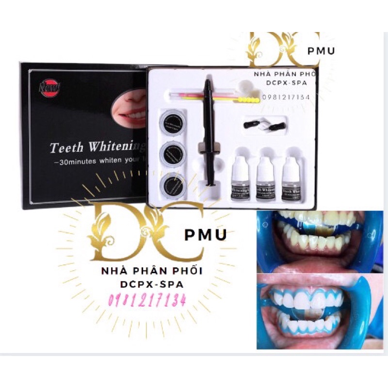 Thuốc tẩy trắng răng