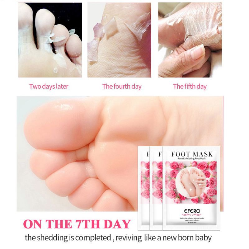 Rose Exfoliating Foot Mask Moisturizing Exfoliation for Legs Heels Remove Dead Skin Pedicure Peeling Feet Mask | BigBuy360 - bigbuy360.vn