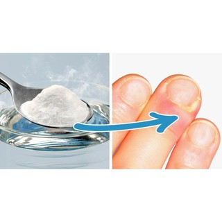 Baking Soda Đa Công Dụng 454g.