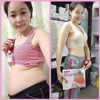 (Combo 1 kem tan mơ+1 đai) Kem tan mỡ Olic