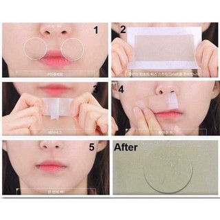 Miếng Dán Wax lông Depilatory