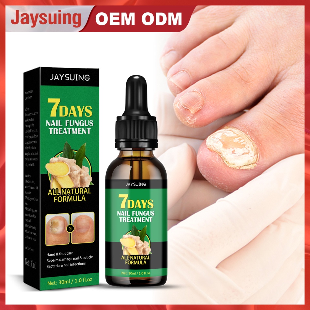 Tinh chất JULYSTAR gừng 7 ngày loại bỏ nấm/ chống nhiễm trùng chăm sóc móng tay/ chân
