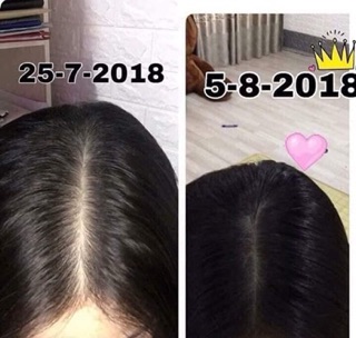 [MUA NHIỀU GIÁ RẺ] COMBO 2 TINH DẦU BƯỞI [POMELO]