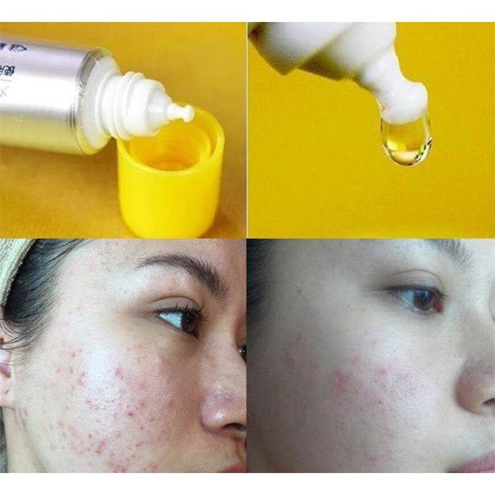 Tinh Chất Dưỡng Da Vitamin C Melano CC Beauty Essence 20ml