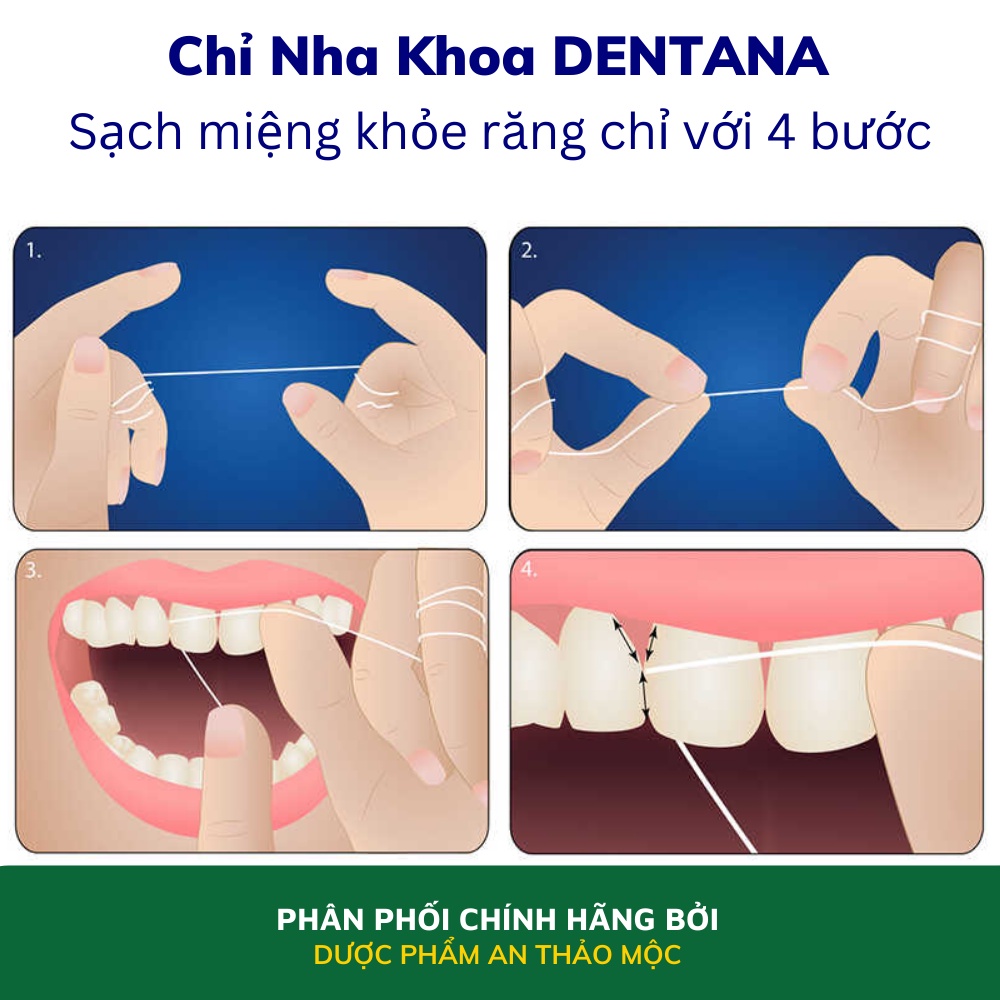 Chỉ nha khoa Tanaphar Dentana loại bỏ các mảng bám chân răng nhẹ nhàng bề mặt răng gúp miệng sạch sẽ răng chắc khỏe