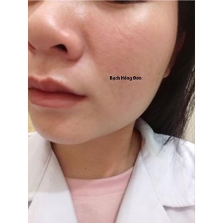 Kem dưỡng Bạch hồng đơn