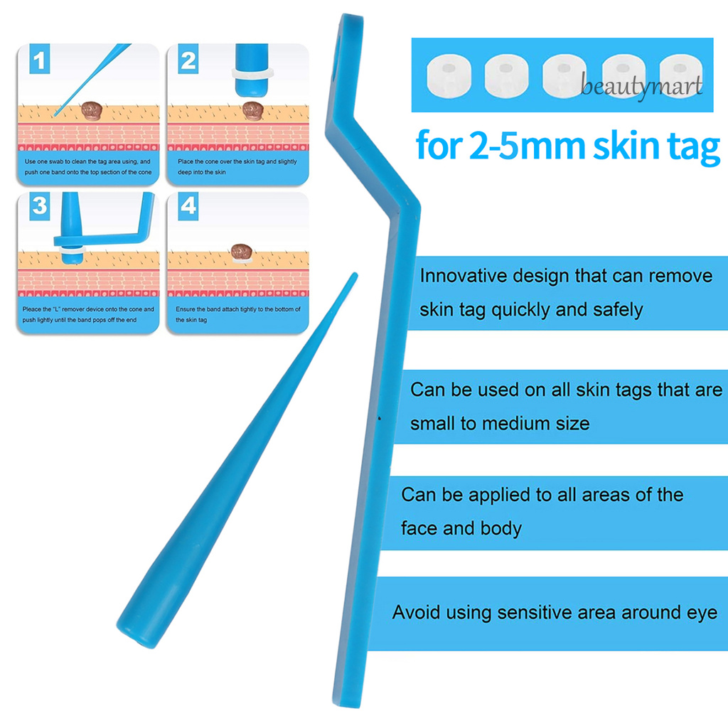 BMR_10Pcs/20Pcs/30Pcs/50Pcs Skin Tag Remover Micro Upgrade Handle ABS Wart Cleansing Tool Kit for Body