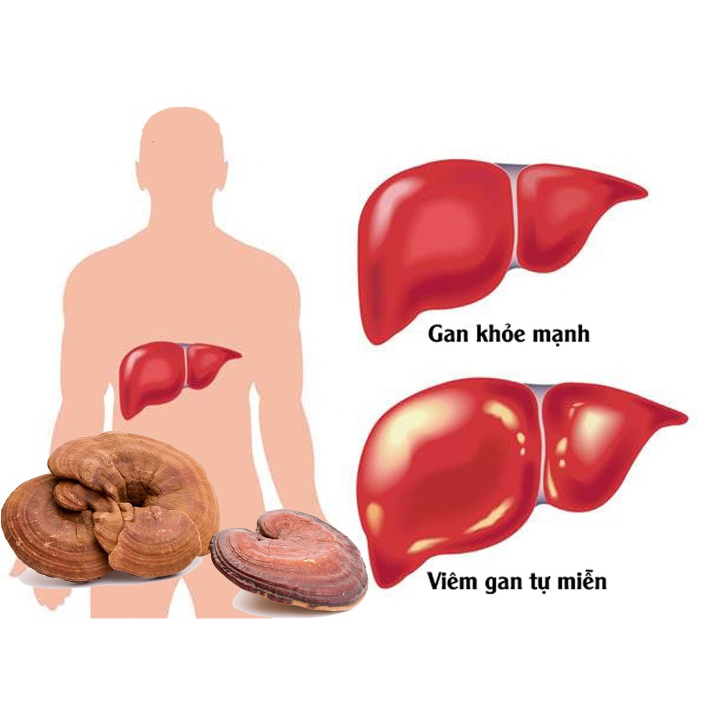 NẤM LINH CHI THÁI LÁT HÀN QUỐC 500G DATE 2025