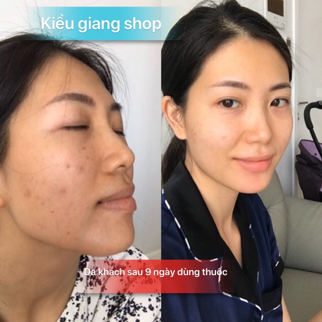 Serum caramel essence( 1 tuần dùng không hiệu quả được đổi trả hoàn tiền) | BigBuy360 - bigbuy360.vn