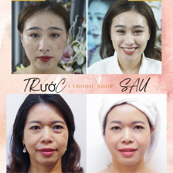 Vitamin E đỏ đẹp da chống lão hoá giảm sạm nám giảm nếp nhăn