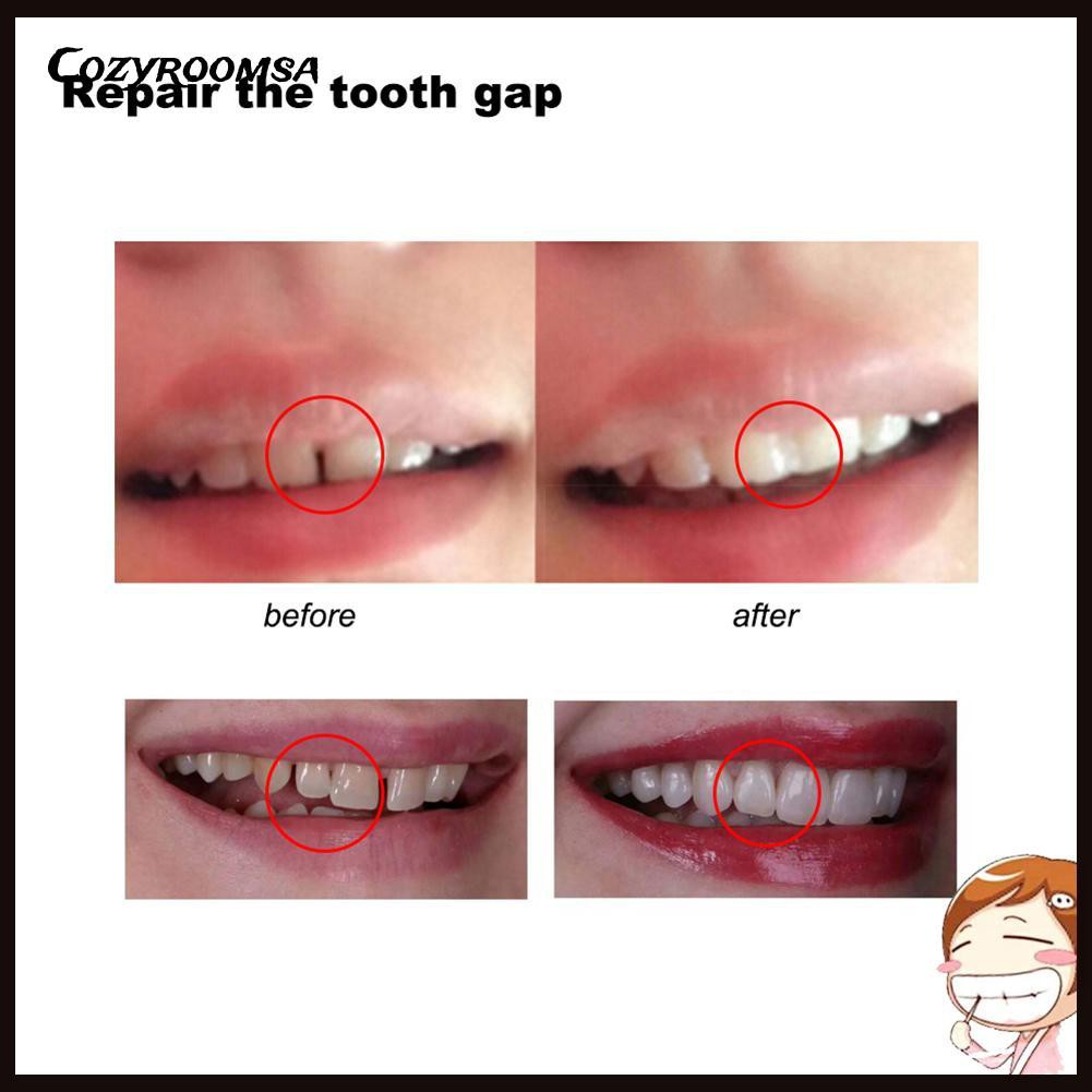 [Hàng mới về] Keo rắn dán răng giả 10g / 100g dùng để sửa chữa răng giả tiện dụng