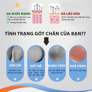 Sỉ 8k Set 2 bọc gót chân silicone chống nứt nẻ chống bong tróc da và giúp làm hồng gót sen - giao màu ngẫu nhiên