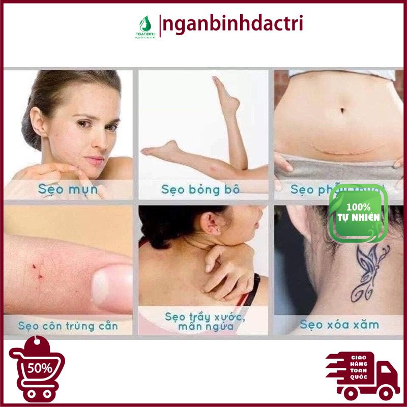 [CAM KẾT 100% CHÍNH HÃNG] Kem mờ sẹo KLIRVIN Nga 25g, giảm sẹo lồi, lõm, sẹo thâm, do mụn