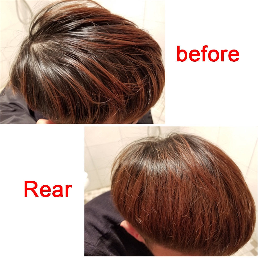 Phấn phủ thấm hút dầu chống bết nhờn dành cho tóc