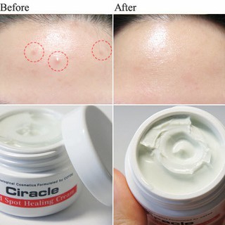 Kem giảm mụn Ciracle Red Spot Cream(30g)