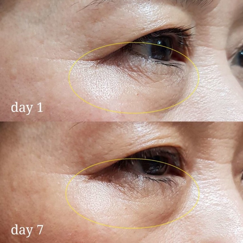 Tinh chất Peptide dưỡng da Matrixyl  giúp căng bóng, chống lão hoá da siêu hiệu quả