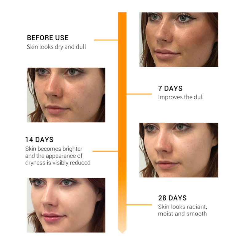 Serum Xixi BREYLEE chứa Hyaluronic Acid Vitamin C làm trắng nuôi dưỡng da
 | BigBuy360 - bigbuy360.vn